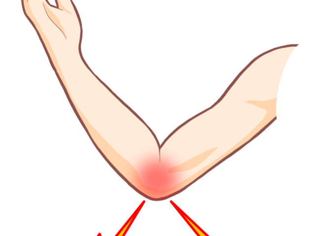 スポーツ以外でも要注意｜ゼロスポ鍼灸・整骨院 北浦和が教える肘の痛みの原因